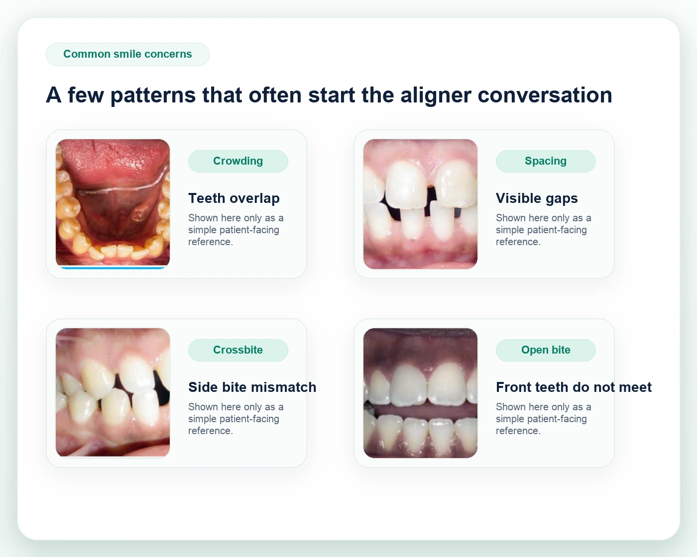 Patient-friendly collage showing examples of crowding, spacing, crossbite, and open bite from clear aligner assessment materials