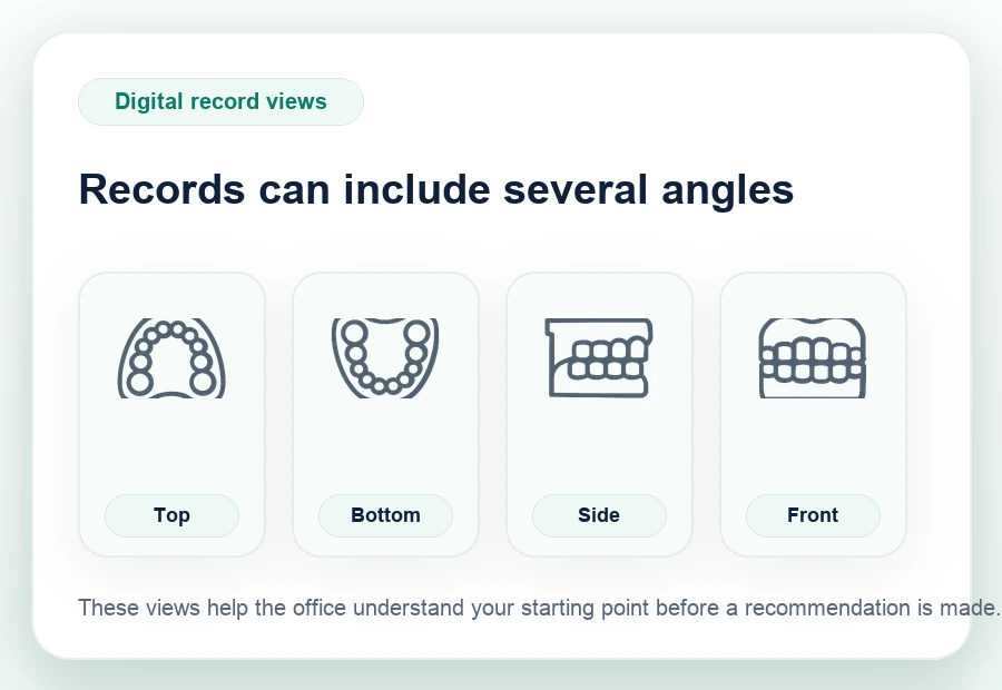 Illustrated top, bottom, side, and front dental views used in digital clear aligner records